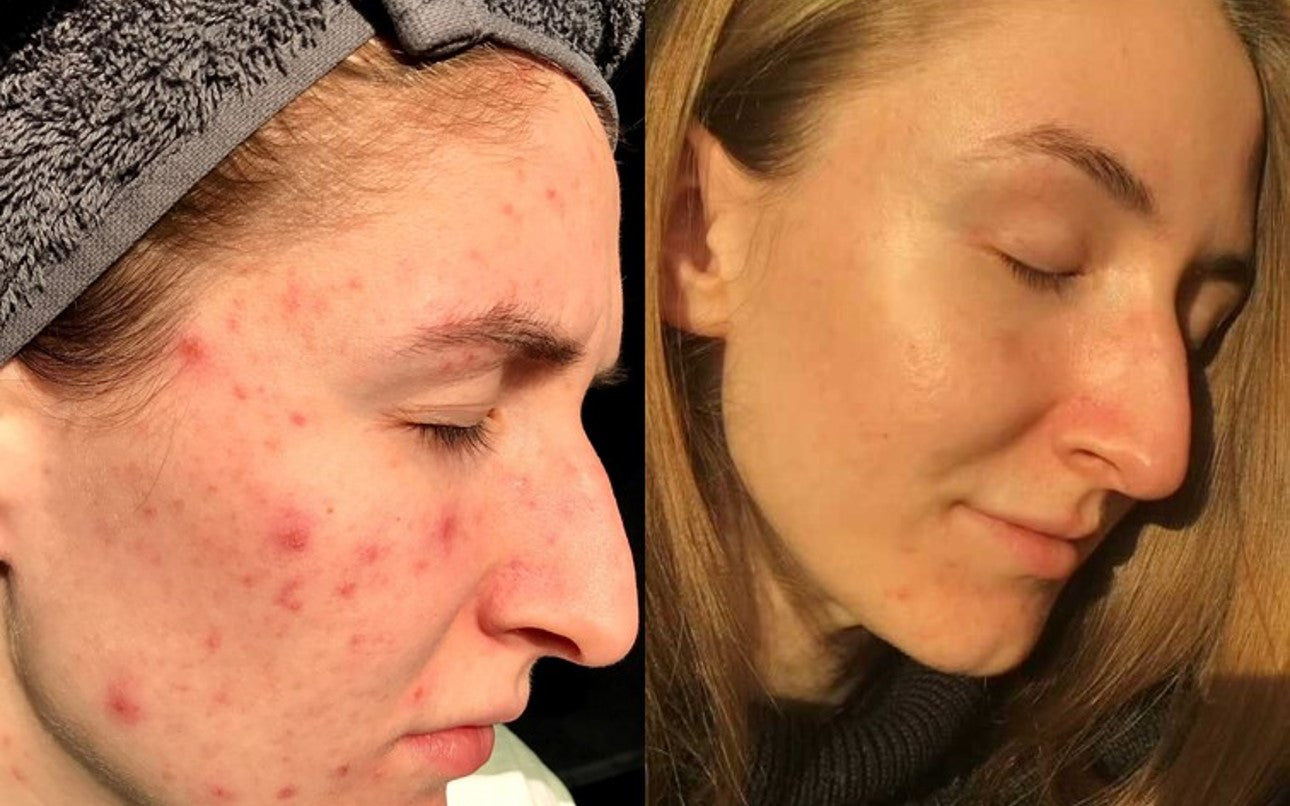Skin glow ups