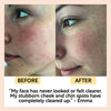 product image-12,Cinnamon + Ginger Chai Cleansing Bar