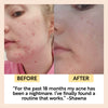 product image-10,Cleansing Face Balm with Vitamin E