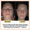 product image-5,Acne-Prone Skincare Bundle