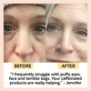 product image-9,Eye Cream with Hyaluronic Acid + Coffee