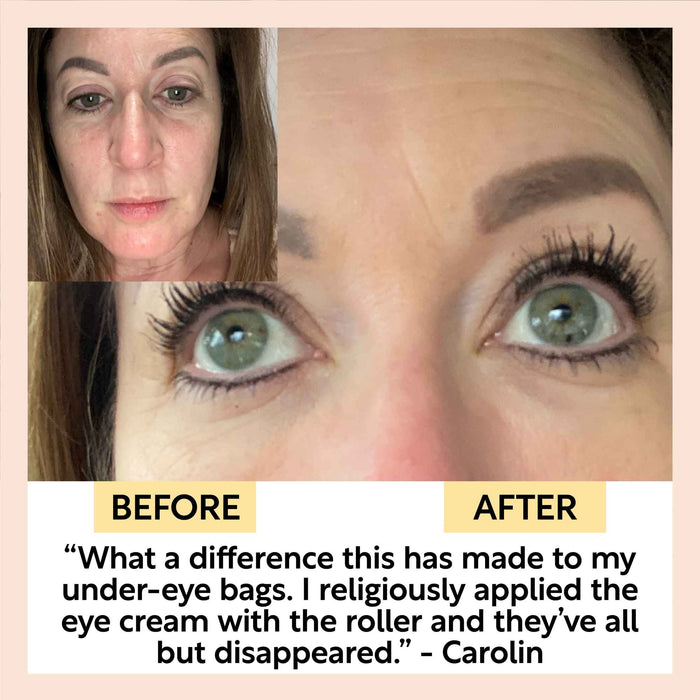small product image-10,Eye Cream with Hyaluronic Acid + Coffee