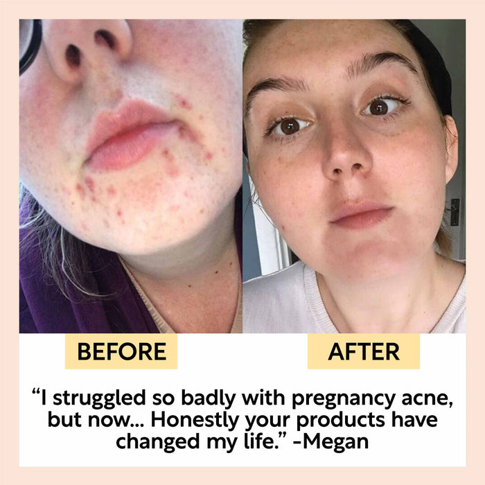 product image-7,Face Moisturiser with Vitamin E - Jumbo