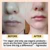 product image-6,The Dry Skin Bundle
