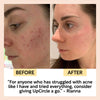 product image-10,Face Toner with Hyaluronic Acid