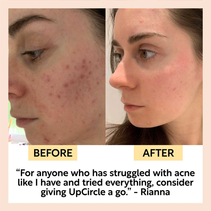 product image-10,Face Toner with Hyaluronic Acid