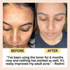 product image-11,Face Toner with Hyaluronic Acid