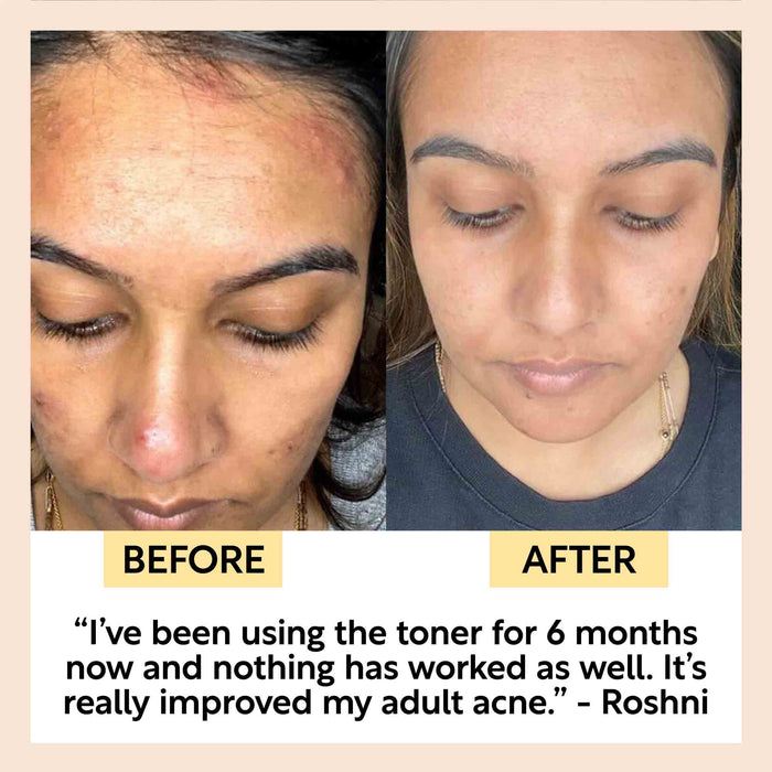 product image-11,Face Toner with Hyaluronic Acid