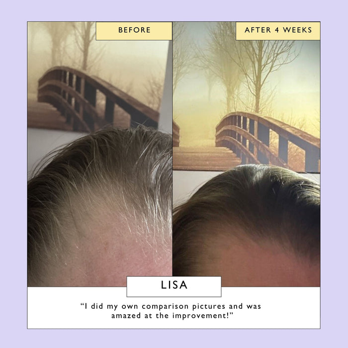 small product image-4,Scalp + Hair Oil with Bacuri Butter + Castor Oil