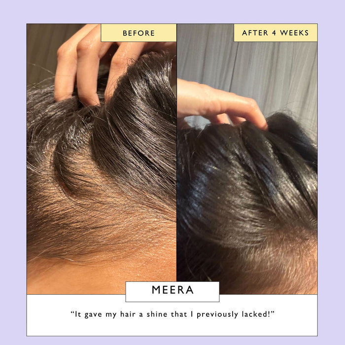 product image-14,Scalp + Hair Oil with Bacuri Butter + Castor Oil