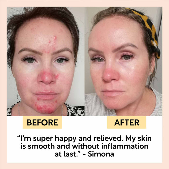small product image-9,Night Cream with Hyaluronic Acid + Niacinamide