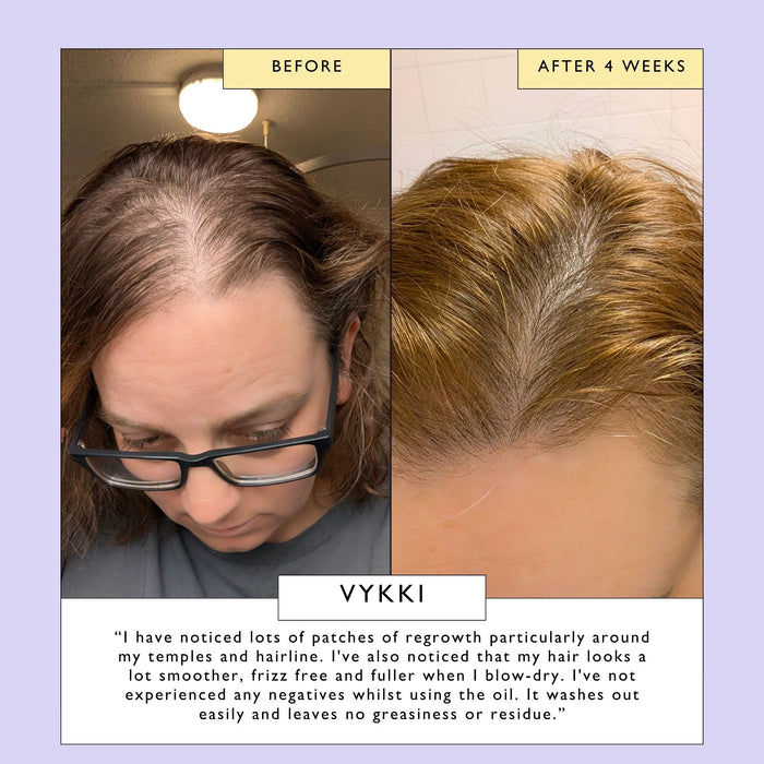 product image-9,Scalp + Hair Oil with Bacuri Butter + Castor Oil